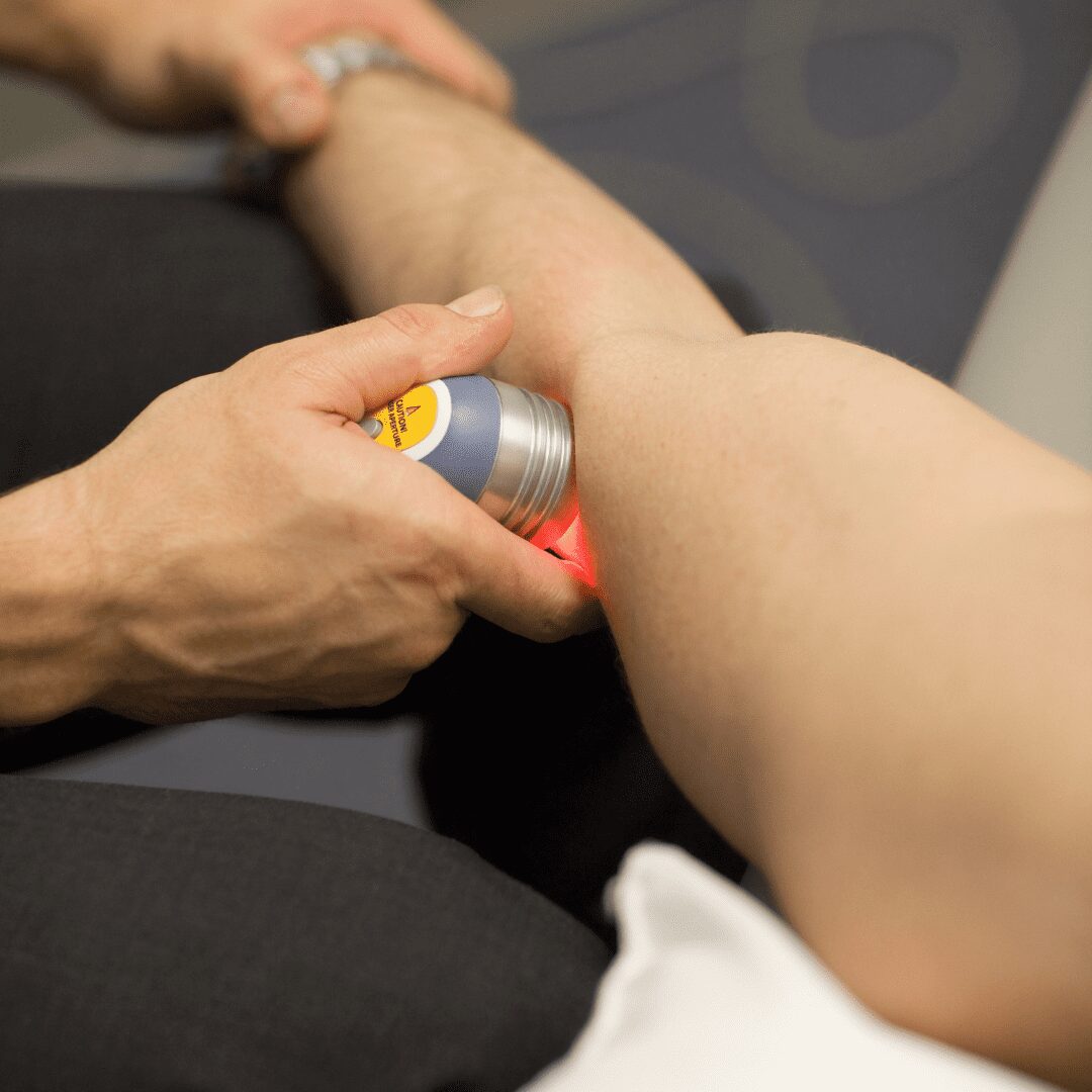 Laser Therapy on arm